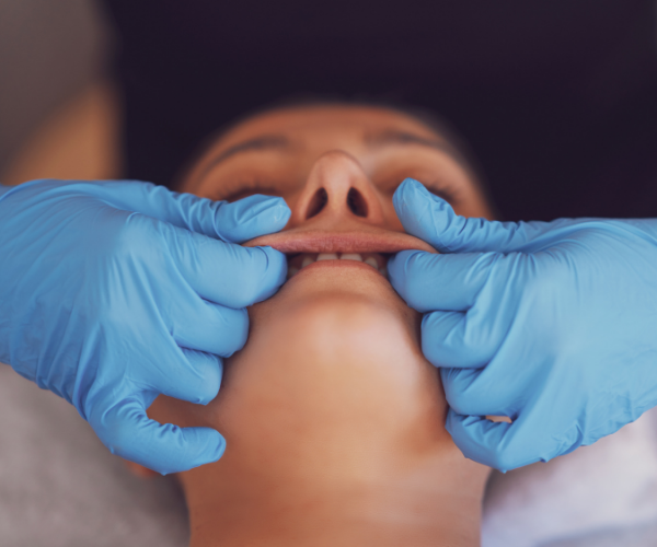 intraoral buccal massage